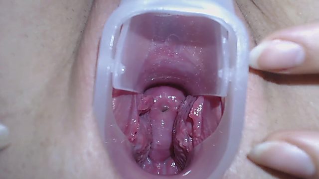 Teenage showing her Cervix with deep and close-up exploration
