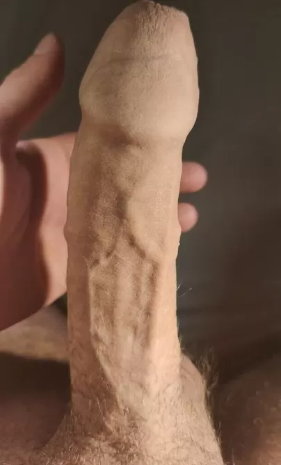 Why is my foreskin so popular here?